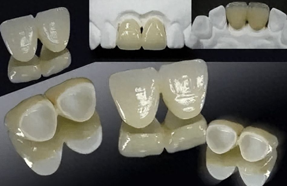 北大口腔医院综合收费价目表：种牙、矫正、镶牙、补牙费用一览